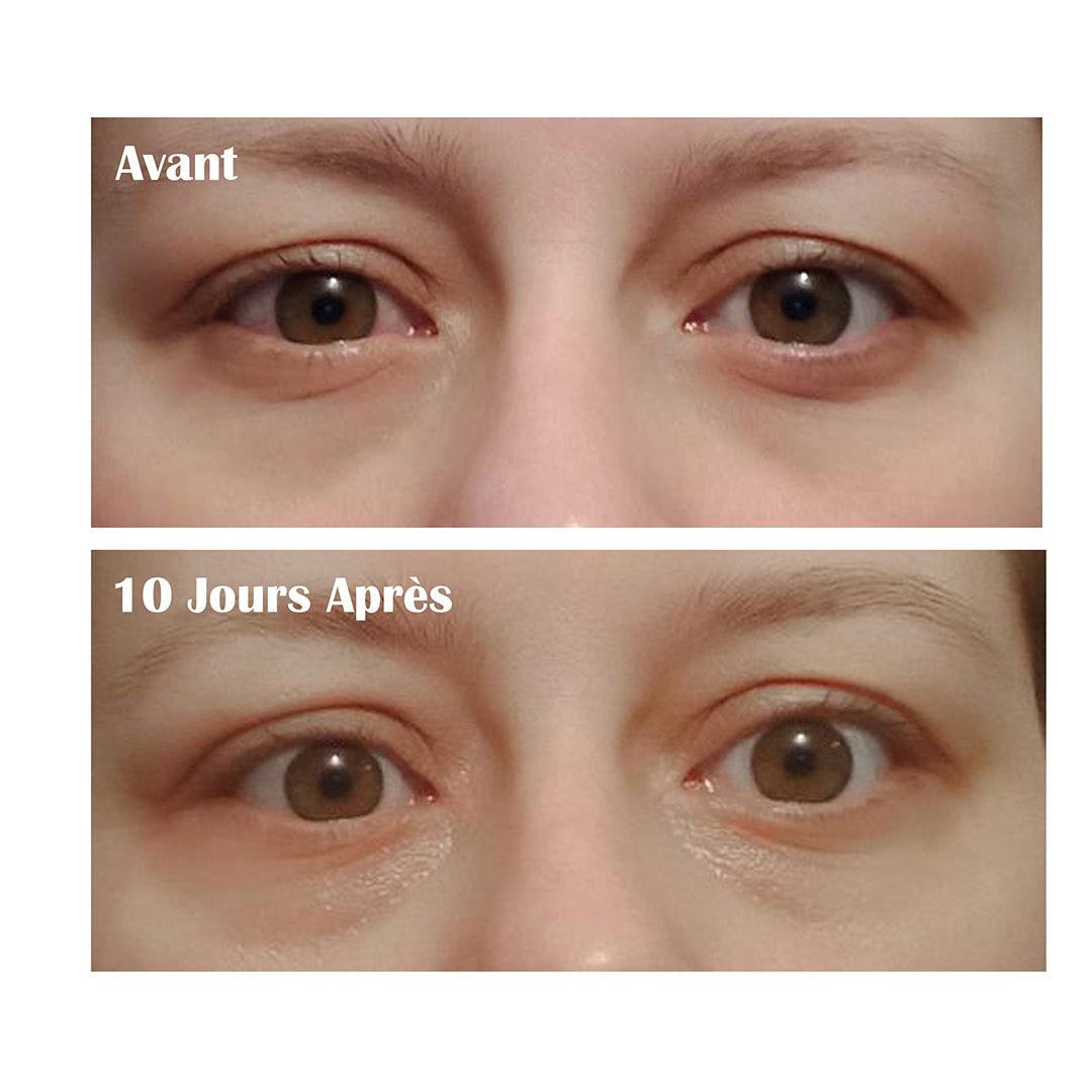 سيروم مضاد للهالات والانتفاخات - مركب زيوت عناية بالوجه - تركيبة عضوية 30مل Sérum Anti - Cernes et Anti - Poches - Complexe Huiles de Soin Visage - Formule Biologique 30ml - Maroc Bio Pharma